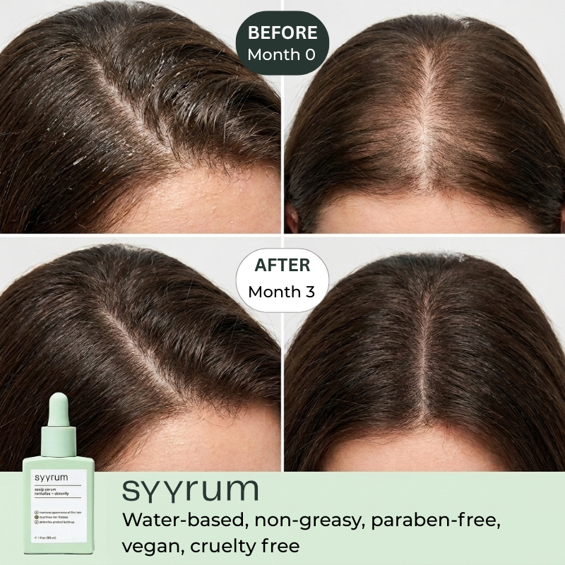 Syyrum before and after comparison